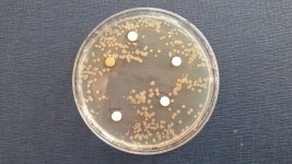 미생물 배양 배지에 미생물을 배양 시켰는데 colony가 형성되었습니다. | 실험 Q&A > 커뮤니티 | BRIC