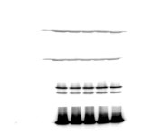 western blot 밴드 끌림 현상 ㅠㅠ | 실험 Q&A > 커뮤니티 | BRIC