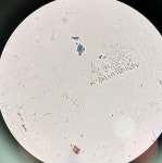 Bacillus wirtz conkin 아포 염색 결과 확인 | 실험 Q&A > 커뮤니티 | BRIC