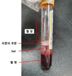 돼지 SST Tube로 채혈 시 겔 처럼 되었다가 층이 생깁니다 | 실험 Q&A > 커뮤니티 | BRIC