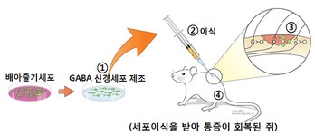척수 손상 후 발생하는 만성적 신경병증 통증, 줄기세포를 이용한 치료가능성 발견 | 뉴스 > Bio뉴스 > 동향 | BRIC