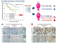 유방암 환자, 방사선 치료효율 높아진다!...방사선 치료 결과 사전 판별할 수 있는 진단지표 개발 | 뉴스 > Bio뉴스 > 동향 | BRIC