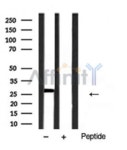 [Affinity] VEGFA Antibody / WNT1 Antibody! | 연구용제품 > Bio마켓 | BRIC