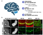 새로운 조현병 원인 유전자 찾았다 | 연구성과 > Bio뉴스 > 동향 | BRIC