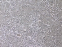 3T3L1 분화중입니다.. 셀 상태가 이상한 것 같습니다. | 실험 Q&A > 커뮤니티 | BRIC