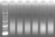 전기영동 밴드 끌림 | 실험 Q&A > 커뮤니티 | BRIC