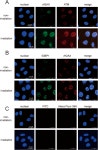 Radiosensitizing Effect of TRPV1 Channel Inhibitors in Cancer Cells