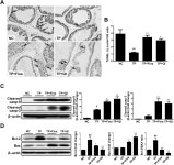 Quisqualis indica Improves Benign Prostatic Hyperplasia by Regulating Prostate Cell Proliferation and Apoptosis Quisqualis indica... 