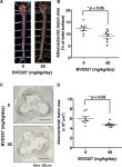 The Anti-atherogenic Activity of Beauveriolide Derivative BVD327, a Sterol O-Acyltransferase 2-Selective Inhibitor, in... 