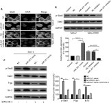MicroRNA-221 Upregulates the Expression of P-gp and Bcl-2 by Activating the Stat3 Pathway to Promote Doxorubicin Resistance in... 