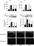 Indomethacin, a Non-steroidal Anti-inflammatory Drug, Induces Skin Dryness via PPARγ in Mice Indomethacin, a Non-steroidal Anti... 