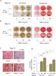 Inhibition of adenosine monophosphate-activated protein kinase suppresses bone morphogenetic protein-2-induced mineralization of... 
