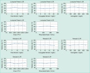 Performance evaluation of the serum-soluble interleukin 2 receptor (sIL-2R) measurement reagents “Lumipulse Presto IL-2R” and... 