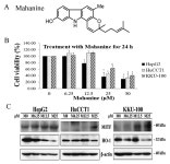 Dysregulated Expression of MITF in Subsets of Hepatocellular Carcinoma and Cholangiocarcinoma