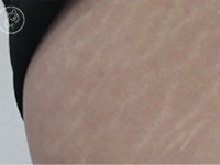 「BEAUTY&YOUNG医院」の写真｜韓国旅行「コネスト」 「BEAUTY&YOUNG医院」の写真