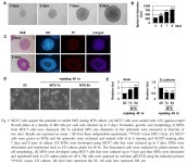 in Multicellular Tumor Spheroid (MTS) Culture-induced Epithelial-mesenchymal Transition -Journal of Life Science | Korea Science