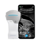 GE 헬스케어, 에디슨 AI 기반의 디지털 헬스케어 솔루션 제시 [이엠디] GE 헬스케어, 에디슨 AI 기반의 디지털  헬스케어 솔루션 제시