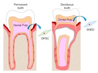 Insight into the Role of Dental Pulp Stem Cells in Regenerative Therapy