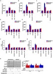 IGF-1/IGF-1R/FAK/YAP Transduction Signaling Prompts Growth Effects in Triple-Negative Breast Cancer (TNBC) Cells