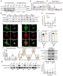 MRIP Regulates the Myosin IIA Activity and DDR1 Function to Enable Collagen Tractional Remodeling
