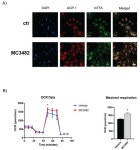 SIRT5 Inhibition Induces Brown Fat-Like Phenotype in 3T3-L1 Preadipocytes