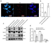 Vesicle-Derived miR-342-5p Ameliorates Beta-Amyloid Formation via Targeting Beta-site APP Cleaving Enzyme 1 in Alzheimer’s Disease
