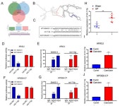 Effect of SNHG11/miR-7-5p/PLCB1 Axis on Acute Pancreatitis through Inhibiting p38MAPK Pathway