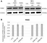 Coagulation Factor Xa Has No Effects on the Expression of PAR1, PAR2, and PAR4 and No Proinflammatory Effects on HL-1 Cells