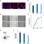 SIRT2 Inhibition by AGK2 Promotes Perinuclear Cytoskeletal Organisation and Reduces Invasiveness of MDA-MB-231 Triple-Negative... 