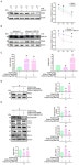 Modification of RNF183 via m6A Methylation Mediates Podocyte Dysfunction in Diabetic Nephropathy by Regulating PKM2... 