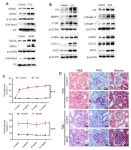 Genes | Free Full-Text | ASH2L Aggravates Fibrosis and... ASH2L Aggravates Fibrosis and Inflammation through HIPK2 in High... 