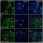 Expression of Congenital Anomalies of the Kidney and Urinary Tract (CAKUT) Candidate Genes EDA2R, PCDH9, and TRAF7 in Normal... 