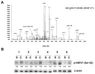 Upregulation of Phosphorylated HSP27, PRDX2, GRP75, GRP78 and... GRP75, GRP78 and GRP94 in Acquired Middle Ear  Cholesteatoma Growth