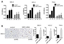 MicroRNA-331-3p Suppresses Cervical Cancer Cell Proliferation and E6/E7 Expression by Targeting NRP2