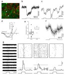 IJMS | Free Full-Text | Degenerated Cones in Cultured Human Retinas Can Successfully Be Optogenetically Reactivated Degenerated... 