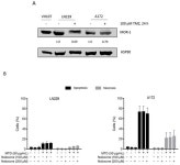 Cytotoxic and Senolytic Effects of Methadone in Combination with Temozolomide in Glioblastoma Cells