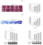 Involvement of the ERK/HIF-1α/EMT Pathway in XCL1-Induced Migration of MDA-MB-231 and SK-BR-3 Breast Cancer Cells