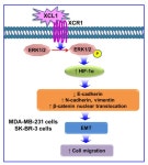 Involvement of the ERK/HIF-1α/EMT Pathway in XCL1-Induced Migration of MDA-MB-231 and SK-BR-3 Breast Cancer Cells