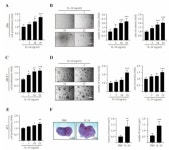 Interleukin-34-CSF1R Signaling Axis Promotes Epithelial Cell Transformation and Breast Tumorigenesis