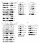 Interleukin-34-CSF1R Signaling Axis Promotes Epithelial Cell Transformation and Breast Tumorigenesis