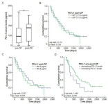 IJMS | Free Full-Text | Levels of Circulating PD-L1 Are... PD-L1 Are Decreased in Patients with Resectable Cholangiocarcinoma