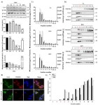 VEGF-R2/Caveolin-1 Pathway of Undifferentiated ARPE-19 Retina Cells: A Potential Target as Anti-VEGF-A Therapy in Wet AMD by... 