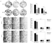 IJMS | Free Full-Text | Fibulin 2 Is Hypermethylated and Suppresses Tumor Cell Proliferation through Inhibition of Cell Adhesion... 
