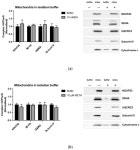 Dopamine and Methamphetamine Differentially Affect Electron Transport Chain Complexes and Parkin in Rat Striatum: New Insight... 