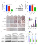 Inhibition of the Monocarboxylate Transporter 1 (MCT1) Promotes 3T3-L1 Adipocyte Proliferation and Enhances Insulin Sensitivity
