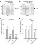 The Cell Adhesion Molecule L1 Interacts with Methyl CpG Binding Protein 2 via Its Intracellular Domain