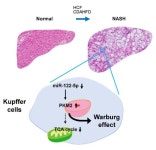 Downregulation of miR-122-5p Activates Glycolysis via PKM2 in Kupffer Cells of Rat and Mouse Models of Non-Alcoholic Steatohepatitis