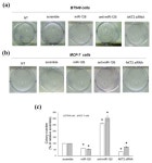 Platelet-Derived miR-126-3p Directly Targets AKT2 and Exerts Anti-Tumor Effects in Breast Cancer Cells: Further Insights in... 