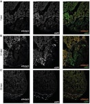 IJMS | Free Full-Text | eif4ebp3l&mdash;A New Affector of Zebrafish Angiogenesis and Heart Regeneration? eif4ebp3l—A New... 
