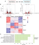 ZNF281 Promotes Colon Fibroblast Activation in TGFβ1-Induced Gut Fibrosis